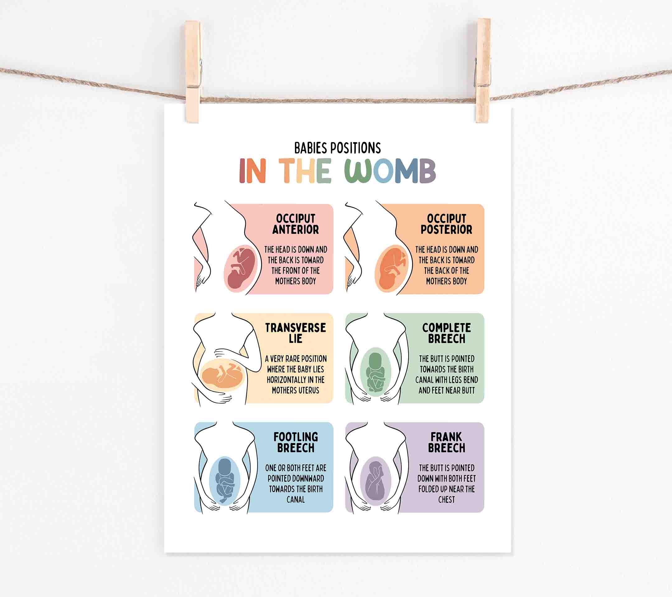 Baby Positions in the Womb Poster (digital Download) Medical Biology ...