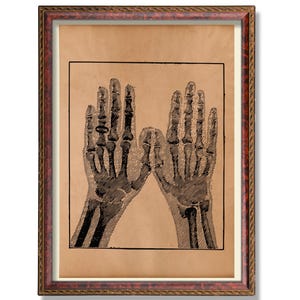 Skeleton Hands Anatomy Illustration Vintage Medical Art Print Rustic Anatomical Hand Poster Antique Osteology Decor Scientific Wall Decor