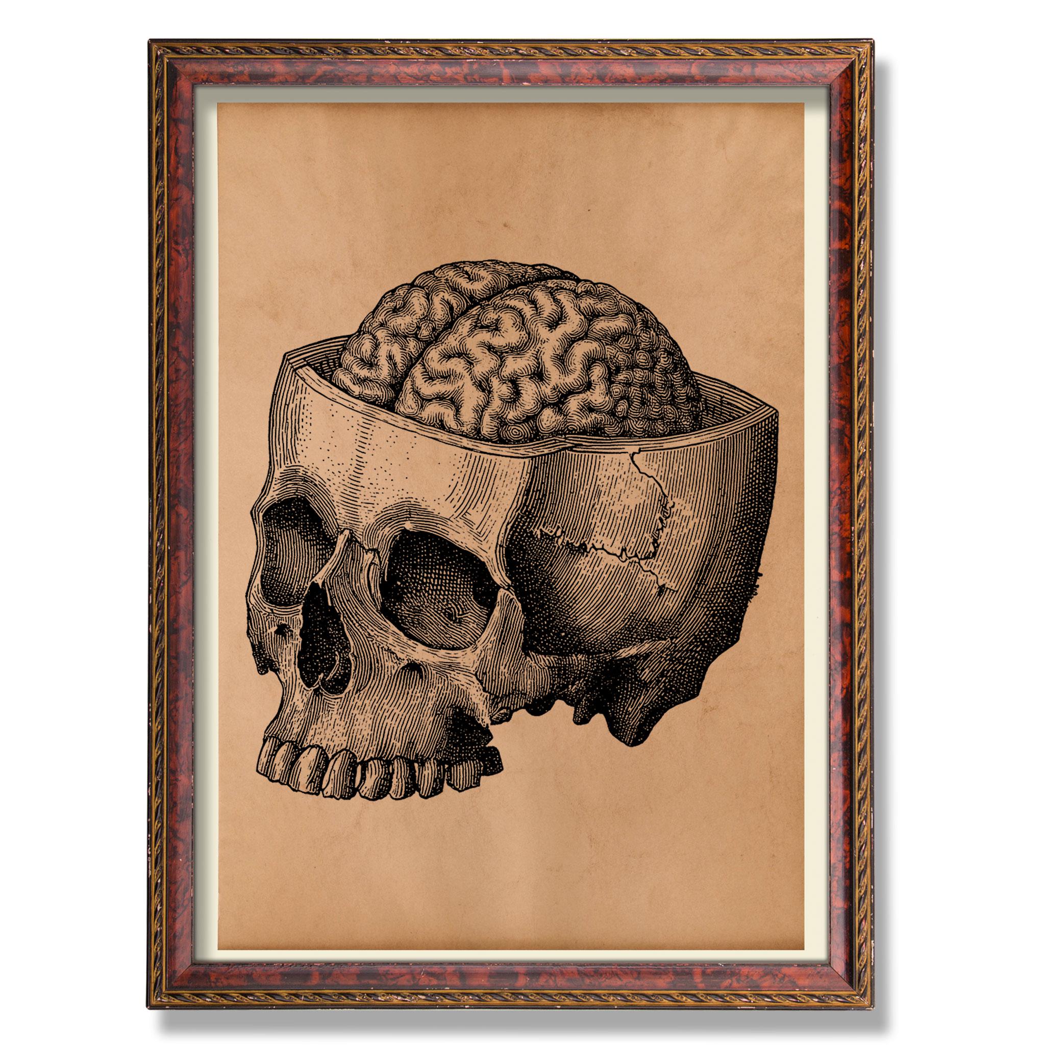 Anatomical Brain in Skull Art - Vintage Medical Illustration Poster, Rustic Anatomy Wall Decor, Antique Science Decoration