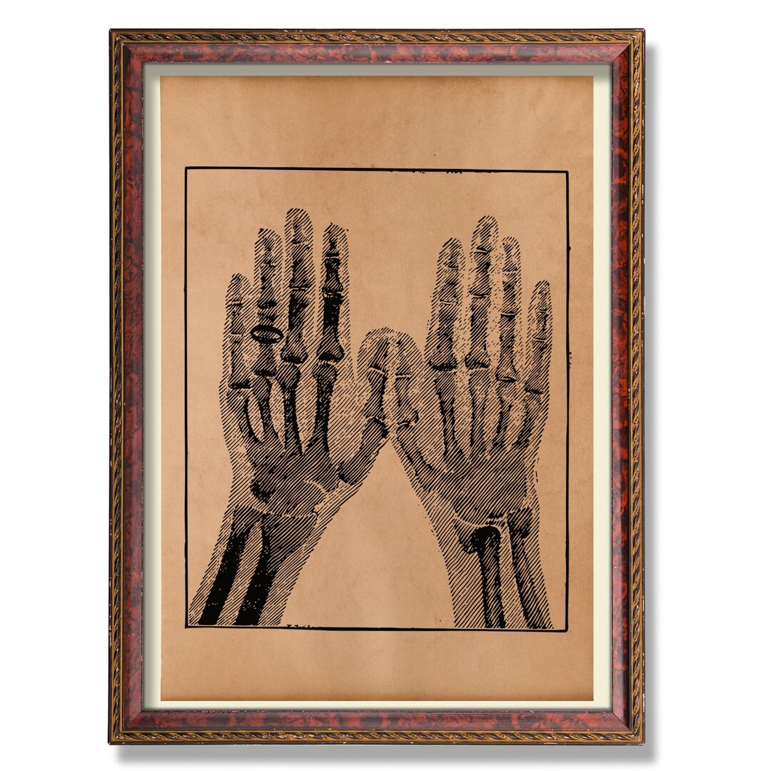 Skeleton Hands Anatomy Illustration Vintage Medical Art Print Rustic ...