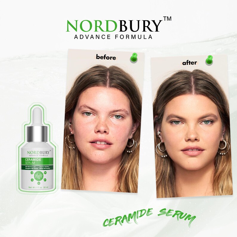 May include: An advertisement for Nordbury Ceramide Serum. The image shows a before-and-after comparison of a woman's face, along with a bottle of the serum. The text on the bottle reads "Ceramide Serum" and "Advance Formula".
