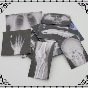 X-Rays Set 1/12 Dollhouse Miniature Printable Digital Download