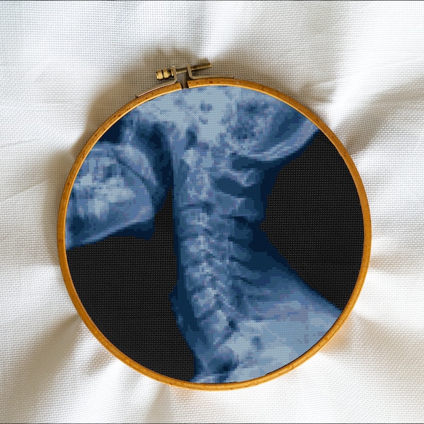 X-Ray, Neck, Spine, Human, Doctor, Health, Roentgenography, Medic, Hospital, Radiography - Modern Cross Stitch, Wall Art, X stitch pattern
