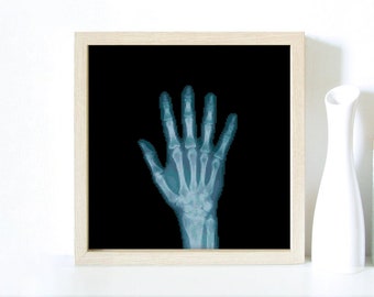 X-Ray, Hand, Palm, Skeleton, Human, Doctor, Roentgenography, Medic, Hospital, Radiography - Modern Cross Stitch, Wall Art, X stitch pattern