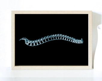 X-Ray, Back, Spine, Human, Doctor, Health, Roentgenography, Medic, Hospital, Radiography - Modern Cross Stitch, Wall Art, X stitch pattern