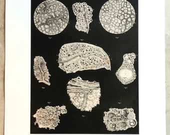 Original 19th century lithograph - Pathological anatomy - Microscopic studies of the lungs - Bourgery and Jacob - Black background