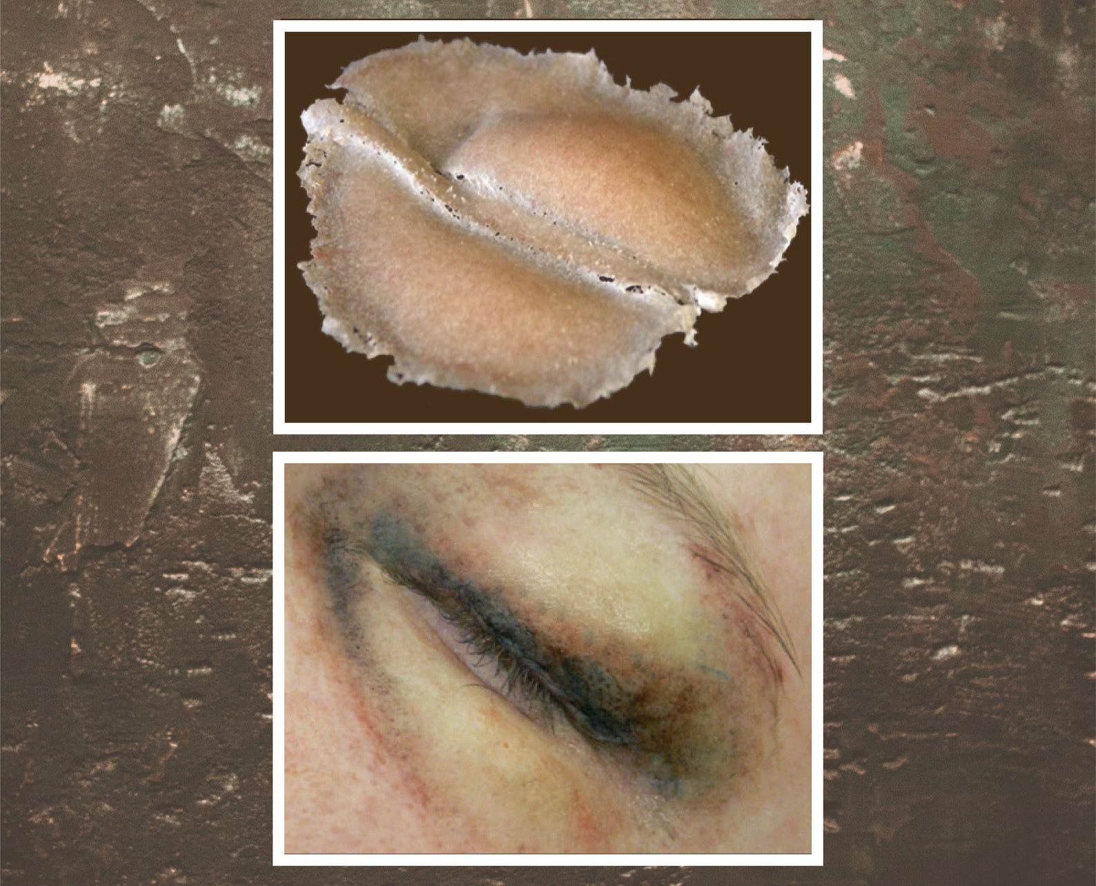 Swollen Eye left Gelatin Prosthetic SB1 Etsy