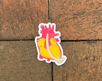 Heartmate 3 Sticker/ Anatomical Heart Sticker/ LVAD Sticker/ Vinyl/ Weatherproof