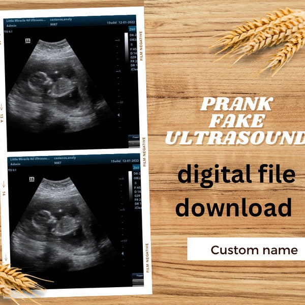 Ultrasound Gag Gift 60+ Gift Ideas for 2023