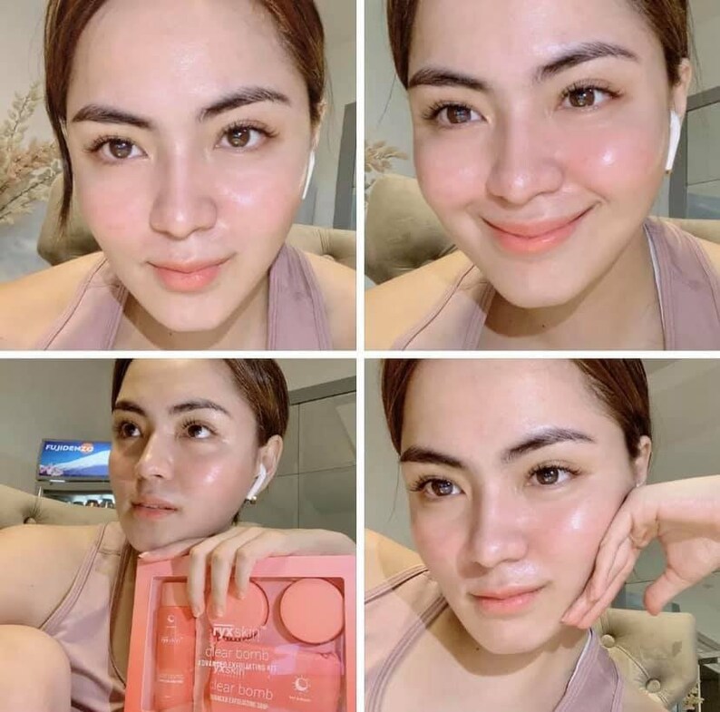 RYX Skin care Clear Bomb Adnvanced Exfoliating Kit | Etsy