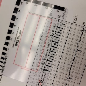 R-Cat EKG-Abzeichen mit wasserdichtem, durchsichtigem Kartenhalter