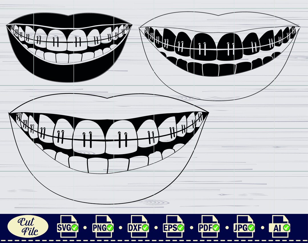 Teeth Braces SVG 2, Tooth Svg, Dentist Svg, Teeth Clipart, Braces Files