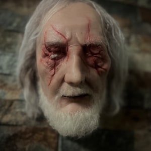 Puede incluir: La cara de un hombre mayor de pelo blanco con marcas rojas y ojos inyectados en sangre. El hombre tiene barba y bigote blancos.