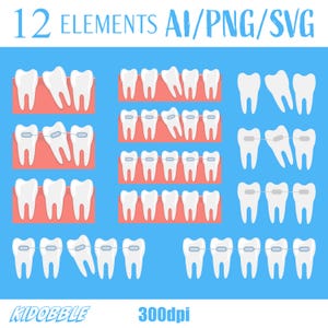 Puede incluir: Un conjunto de 12 ilustraciones de dibujos animados de dientes con y sin frenos. Los dientes son blancos y los frenos son plateados. Las ilustraciones están sobre un fondo azul con el texto "12 ELEMENTS AI/PNG/SVG" y "KIDOBBLE 300dpi".