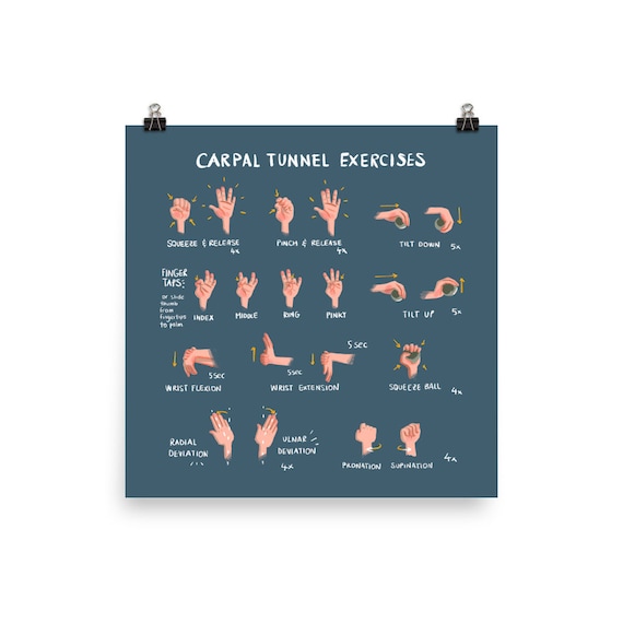 Carpal Tunnel Exercises Print Physical Blue Hand and Wrist
