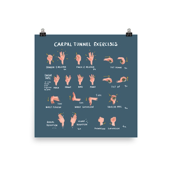 Carpal Tunnel Exercises Print Physical Blue Hand and Wrist Exercises for Carpal Tunnel Relief Etsy
