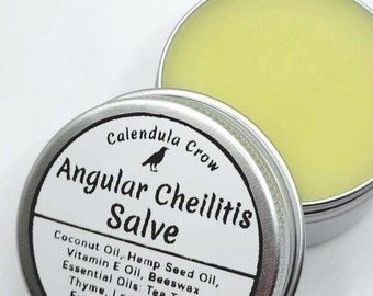 Angular Cheilitis Salve