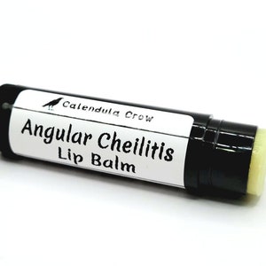 Angular Cheilitis Lip Balm image 1