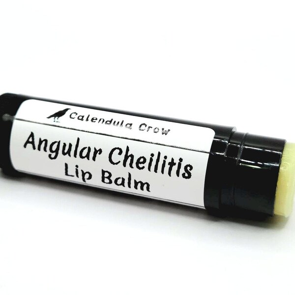 Angular Cheilitis Lip Balm