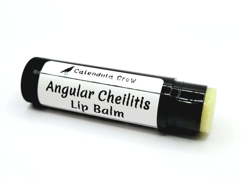 Angular Cheilitis Lip Balm Cheilosis Corner of Mouth Etsy