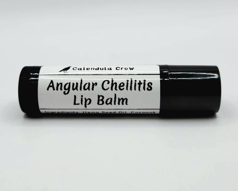 Angular Cheilitis Lip Balm Cheilosis Corner of Mouth Etsy