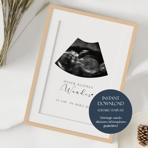 Póster con imagen de ultrasonido, regalo personalizado, plantilla de póster para futura madre, imagen de pared de embarazo imprimible, decoración de guardería, bebé, descarga