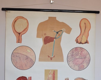 Wall Chart - Cancer (anatomy biology school medical poster print old education diseases abnormal cells breast tissue organ skin pull down)