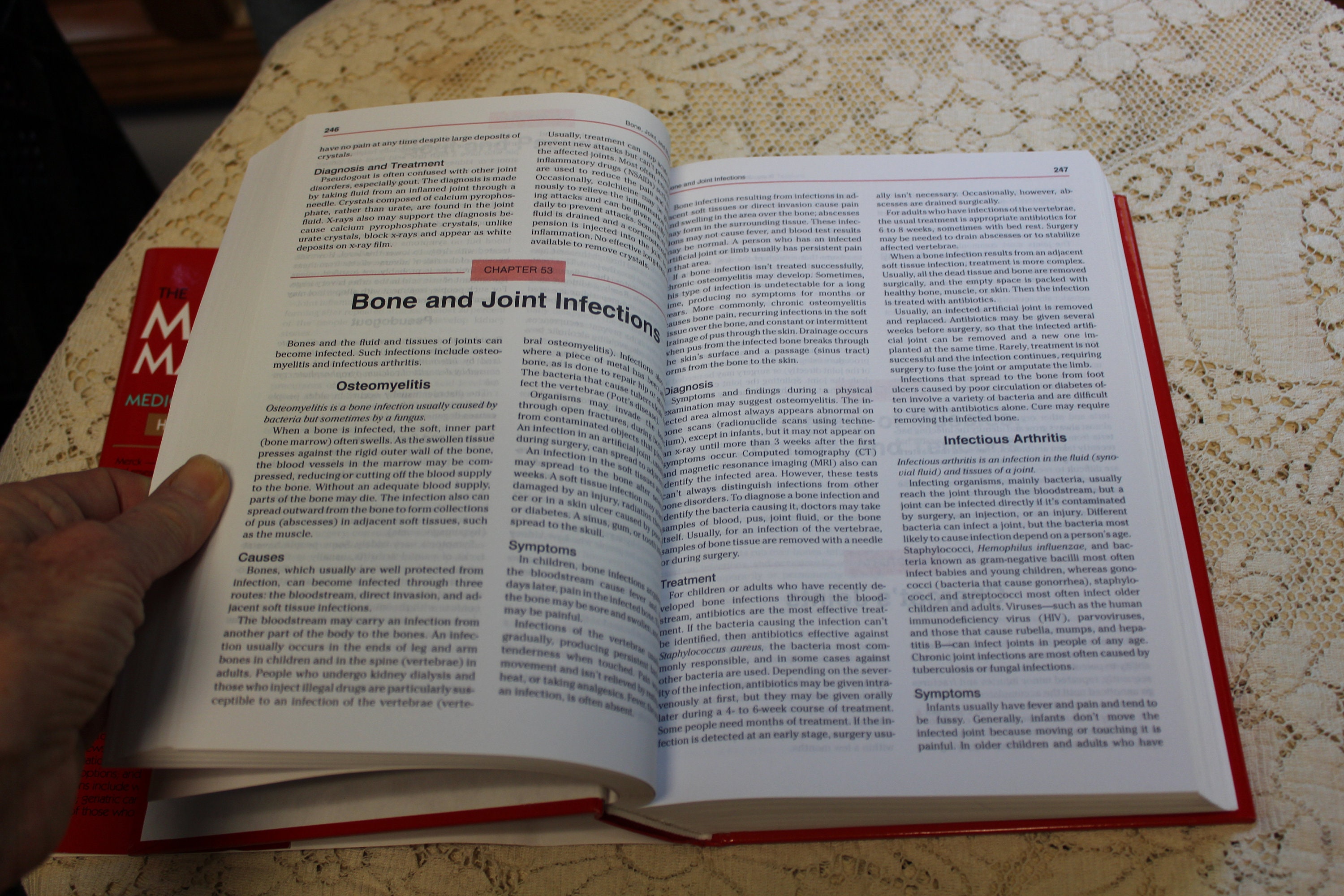 The Merck Manual of Medical Information, Home Edition / Robert Berkow ...