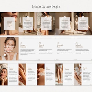 May include: A promotional image with the text "Includes Carousel Designs" at the top. The image is a carousel of skincare tips, including "4 signs your skin needs acne care." The image features models and text descriptions.