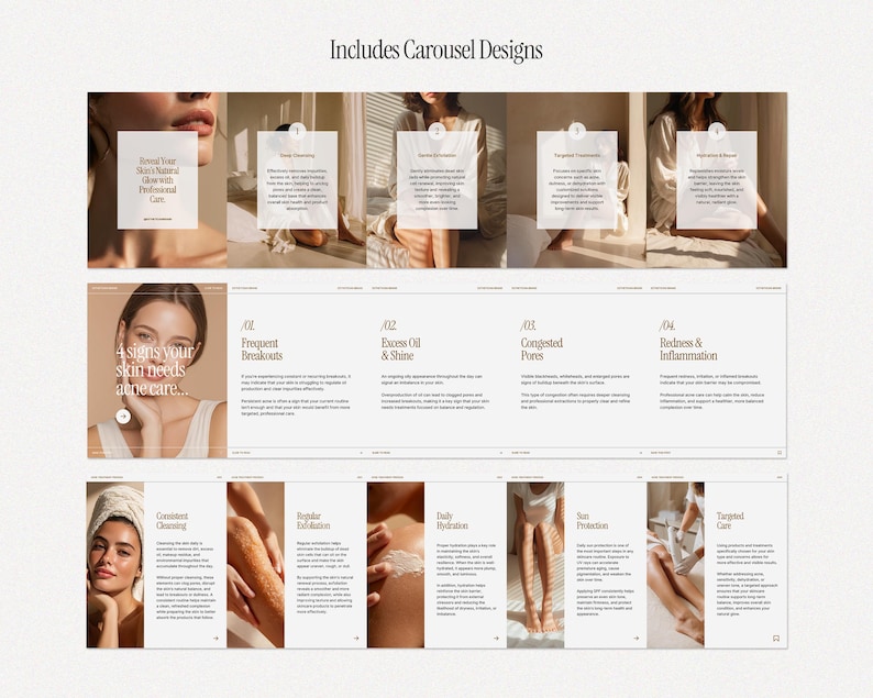 May include: A promotional image with the text "Includes Carousel Designs" at the top. The image is a carousel of skincare tips, including "4 signs your skin needs acne care." The image features models and text descriptions.
