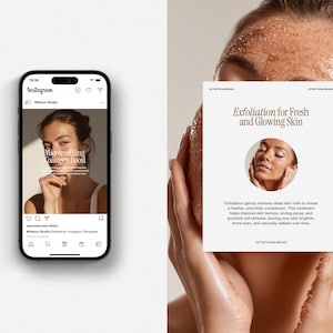 May include: An image featuring a smartphone displaying an Instagram post about microneedling collagen boost. Beside it, a person holds a card promoting exfoliation for fresh and glowing skin, with text and a circular image of a person's face.