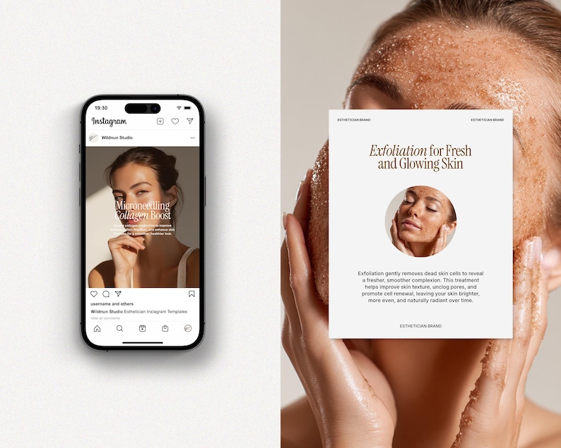 May include: An image featuring a smartphone displaying an Instagram post about microneedling collagen boost. Beside it, a person holds a card promoting exfoliation for fresh and glowing skin, with text and a circular image of a person's face.