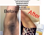 UnderArm Brightening Turmeric Lemon Natural Deodorant