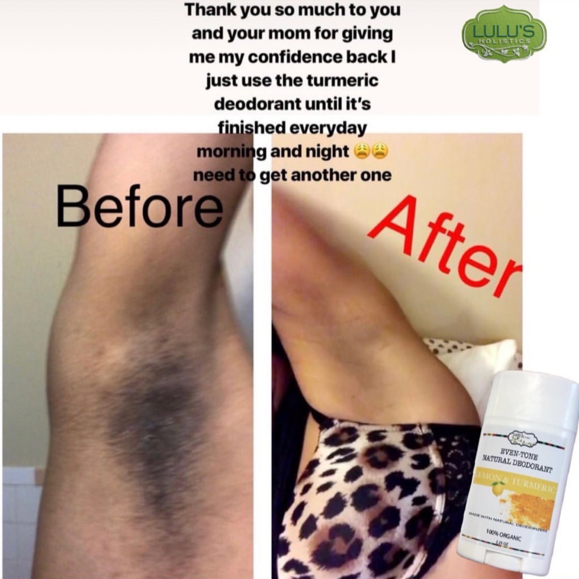 Underarm Brightening Turmeric & Lemon Natural Deodorant - Etsy New Zealand Underarm Brightening Turmeric & Lemon Natural Deodorant - Etsy New Zealand