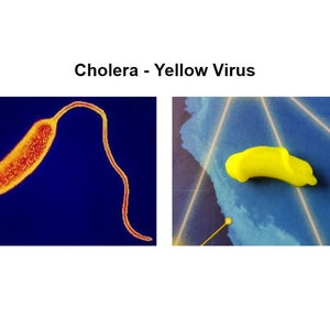 May include: A microscopic image of a cholera bacterium, a curved, rod-shaped bacterium, in orange and red against a blue background.  A yellow, rubber-like object, shaped like a banana, is shown on a blue background with white lines.