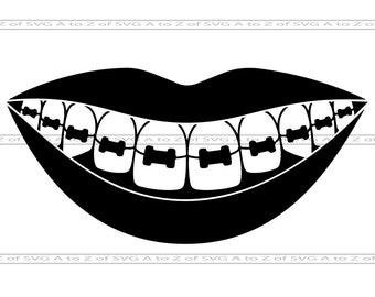 Free Free Smile With Braces Svg 290 SVG PNG EPS DXF File