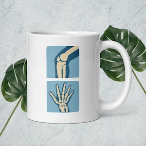 Könnte beinhalten: Weiße Keramiktasse mit einer blauen und weißen Illustration einer Röntgenaufnahme von Knie und Hand. Die Röntgenbilder sind in einem quadratischen Rahmen.