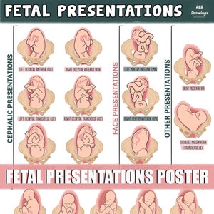 Foetale presentaties poster