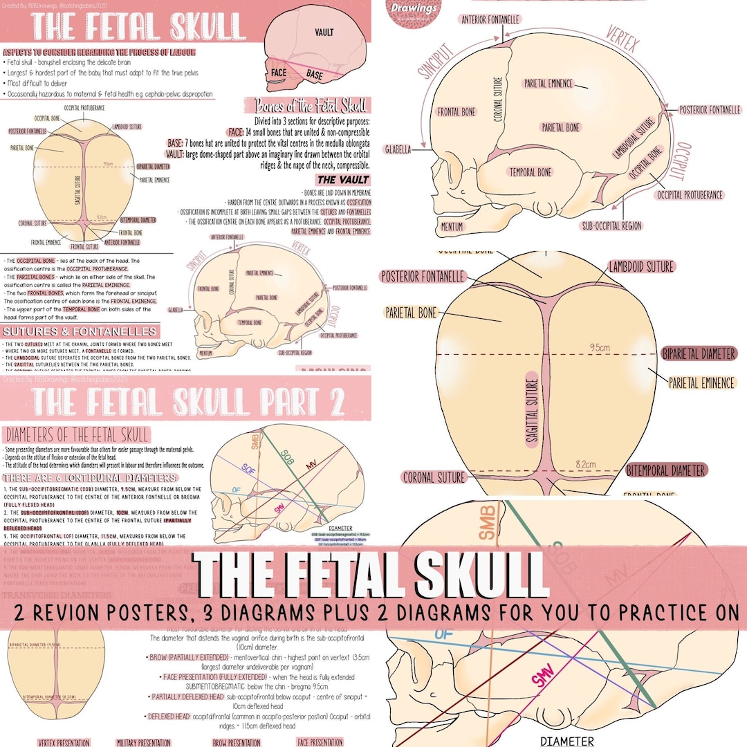 Vertex In Fetal Skull | lupon.gov.ph