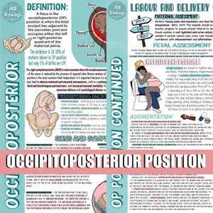 Posizione occipito-posteriore