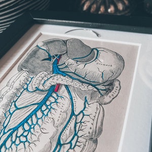 Authentic Surgical Needle & Abdominal Organs Grey&#39;s Anatomy Picture Frame Wall art Upcycled Oddity Rare Weird Gothic Medical Vintage Stomach