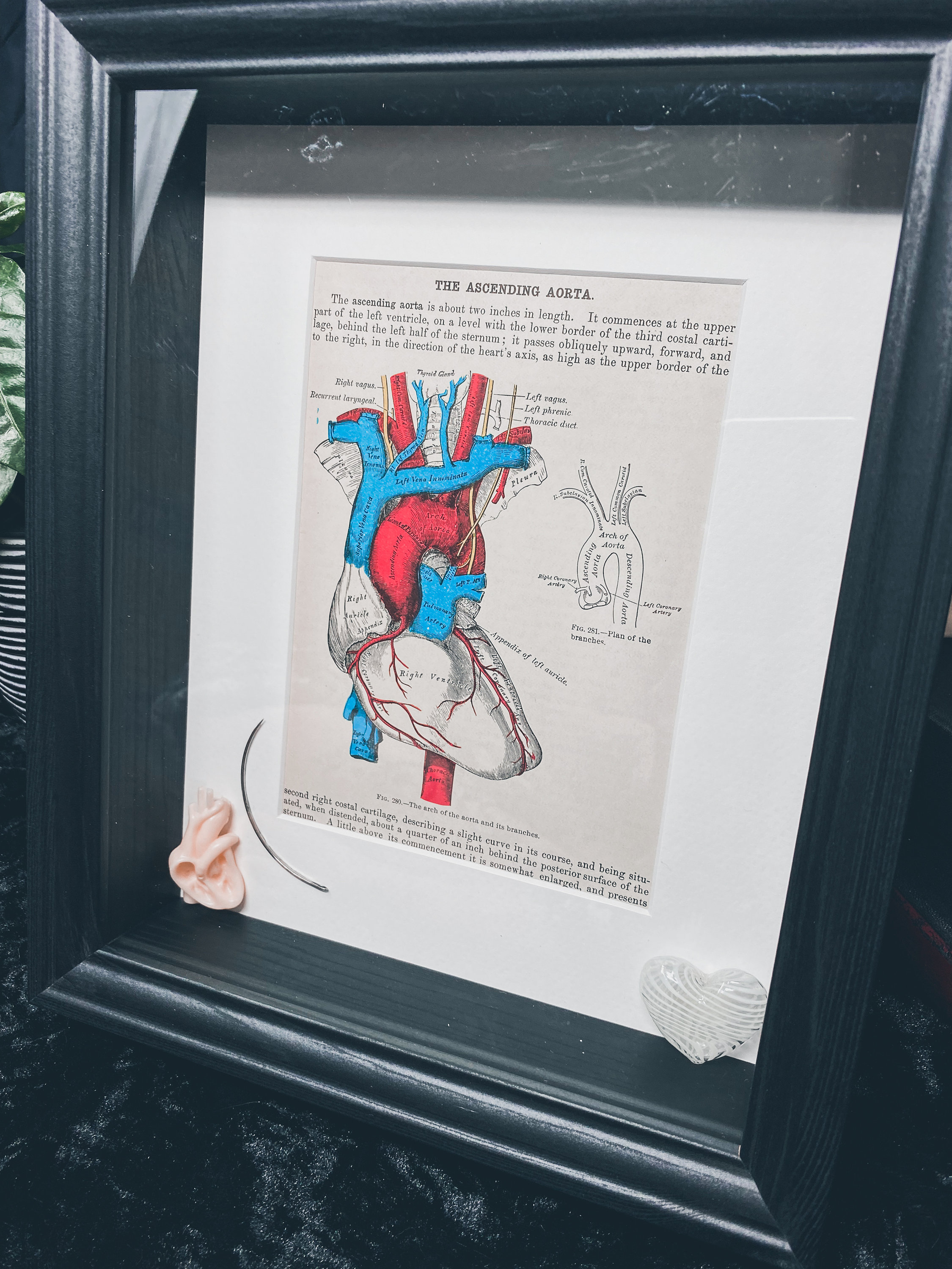 Authentic Surgical Needle & Human Heart Grey's Anatomy Picture Frame  Upcycled Oddity Rare Weird Gothic Medical Vintage Aorta Vintage