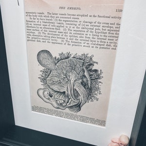 Authentic Surgical Needle & Embryo Grey&#39;s Anatomy Picture Frame  Wall art Upcycled Oddity Rare Weird Gothic Medical Vintage Muscles Fetus
