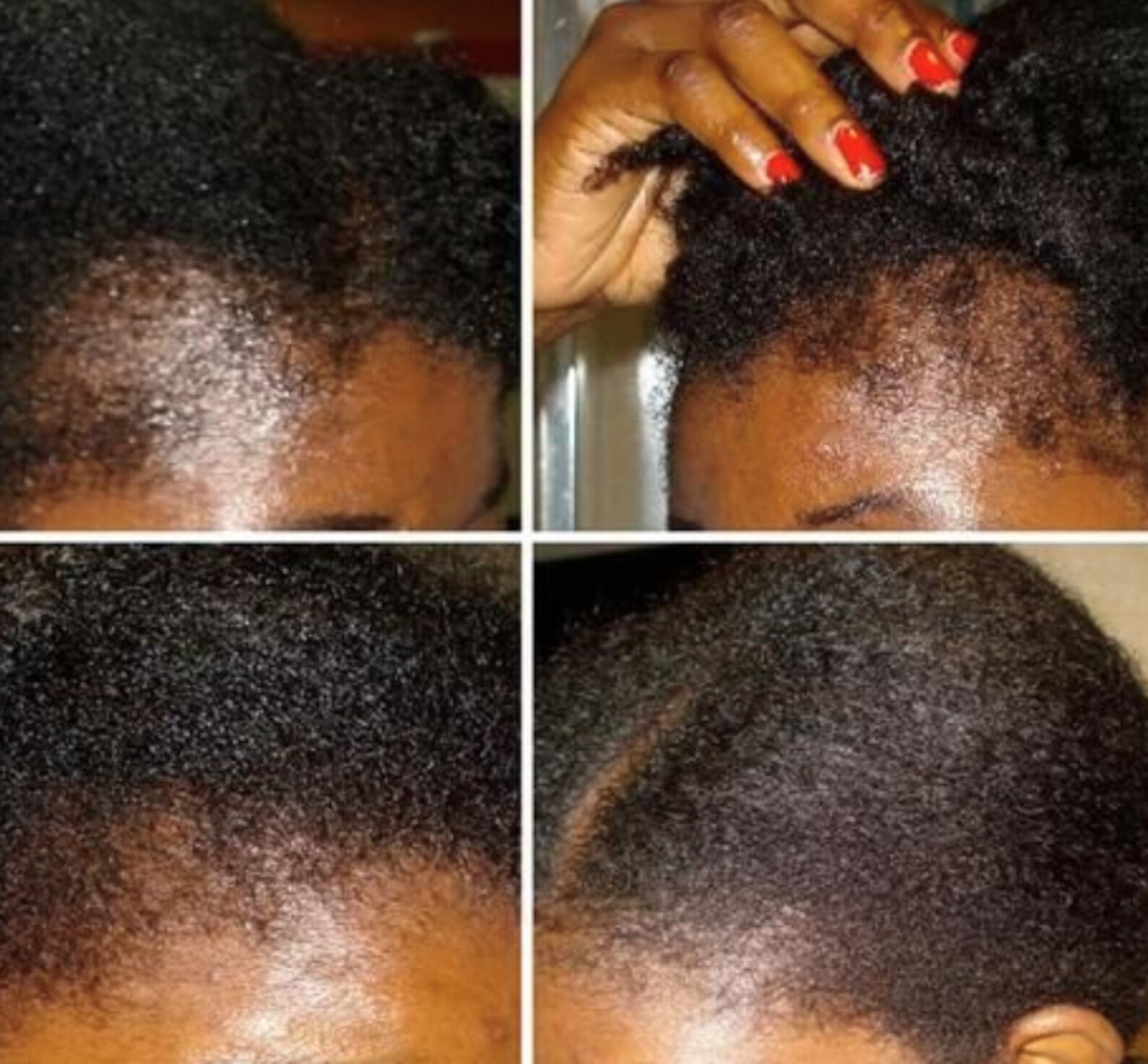 Sea Moss Hair Vitamins Hair Growth Vitamins Organic Etsy