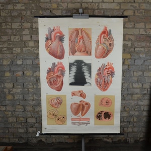 Menschliches Herz, Anatomisches Poster: original Vintage 1950er Deutsche Medizin Lehrtafel Schulwandkarte Anatomie Druck Blut brust Röntgen