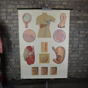 Krebs, Onkologie: original Vintage 1950er Jahre Lehrposter Schule Lehrtafel anatomischer Druck medizinisch Kuriosität Krankheit antike Kuriosität