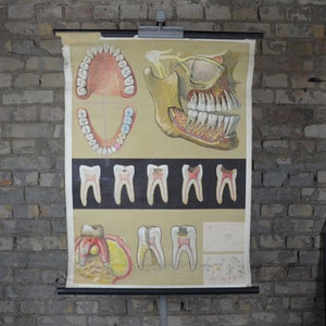 Anatomía de los dientes humanos, dentición: original antiguo de la década de 1920, cartel de la escuela educativa alemana, gráfico de pared médica, dentista enrollable, diente impreso
