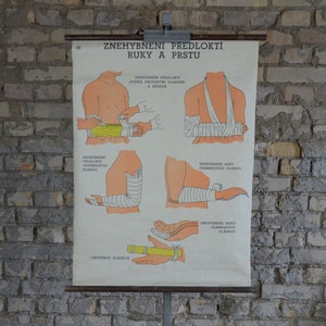 Behelfsarm & Handschiene, Bandagen: original vintage 1950er Jahre Tschechisches Lehrposter Medizin Schulkarte anatomischer Druck Arzt Krankenschwester