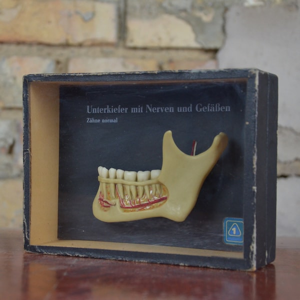 Dientes humanos, nervios de la mandíbula: original vintage 1950s cera moulage modelo anatómico anatomía alemana médico educativo dentista odontología anatomía cráneo