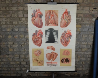 Puede incluir: Gráfico anatómico vintage del corazón humano, con ilustraciones detalladas del corazón en varias etapas de disección. El gráfico está impreso en papel color crema y está montado en un rodillo.